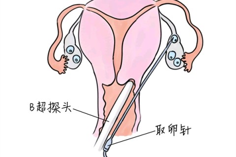 http://dalian.vdtfzz.com/post/205.html|大连供卵助孕